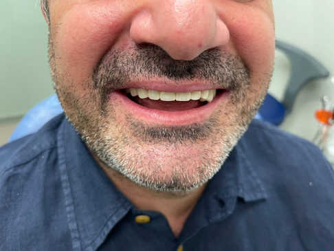 Slider image (10) Neo Dental Clinic